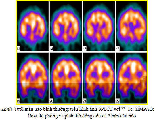 2015-11-23_151132